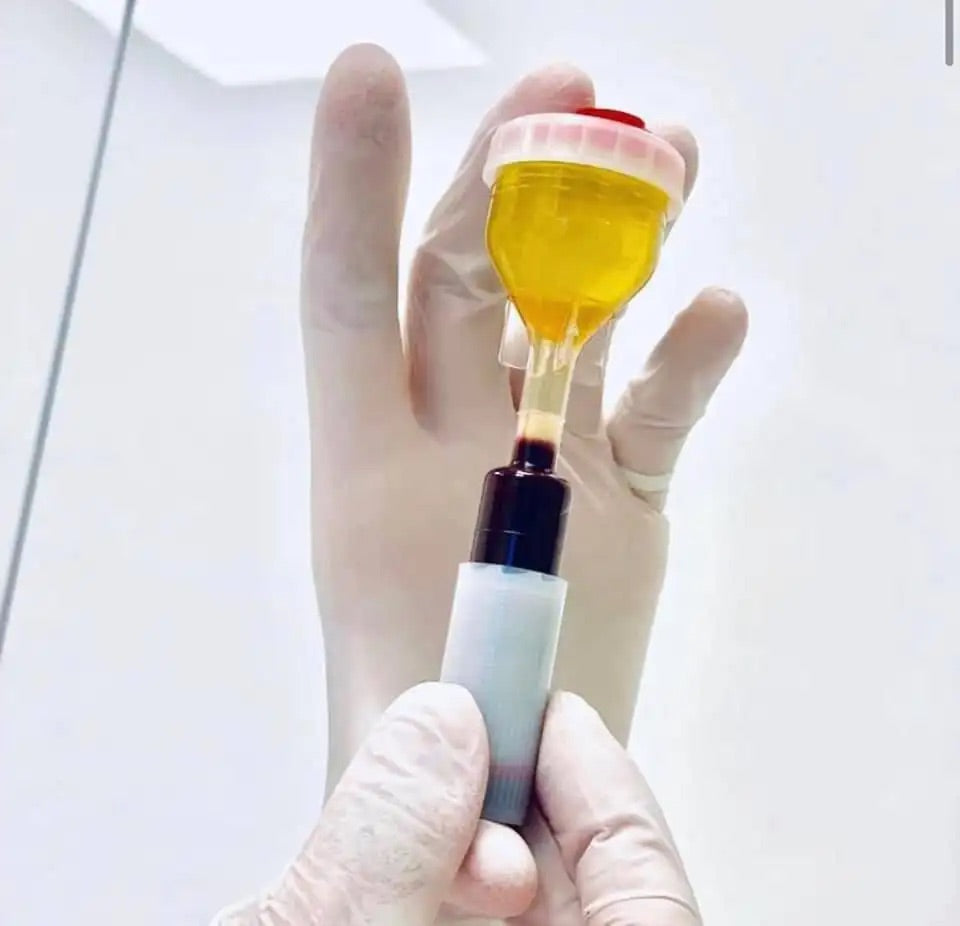Y-PRP Tubes NO Additives for Hair Orthopedics PET Tubes Sterile